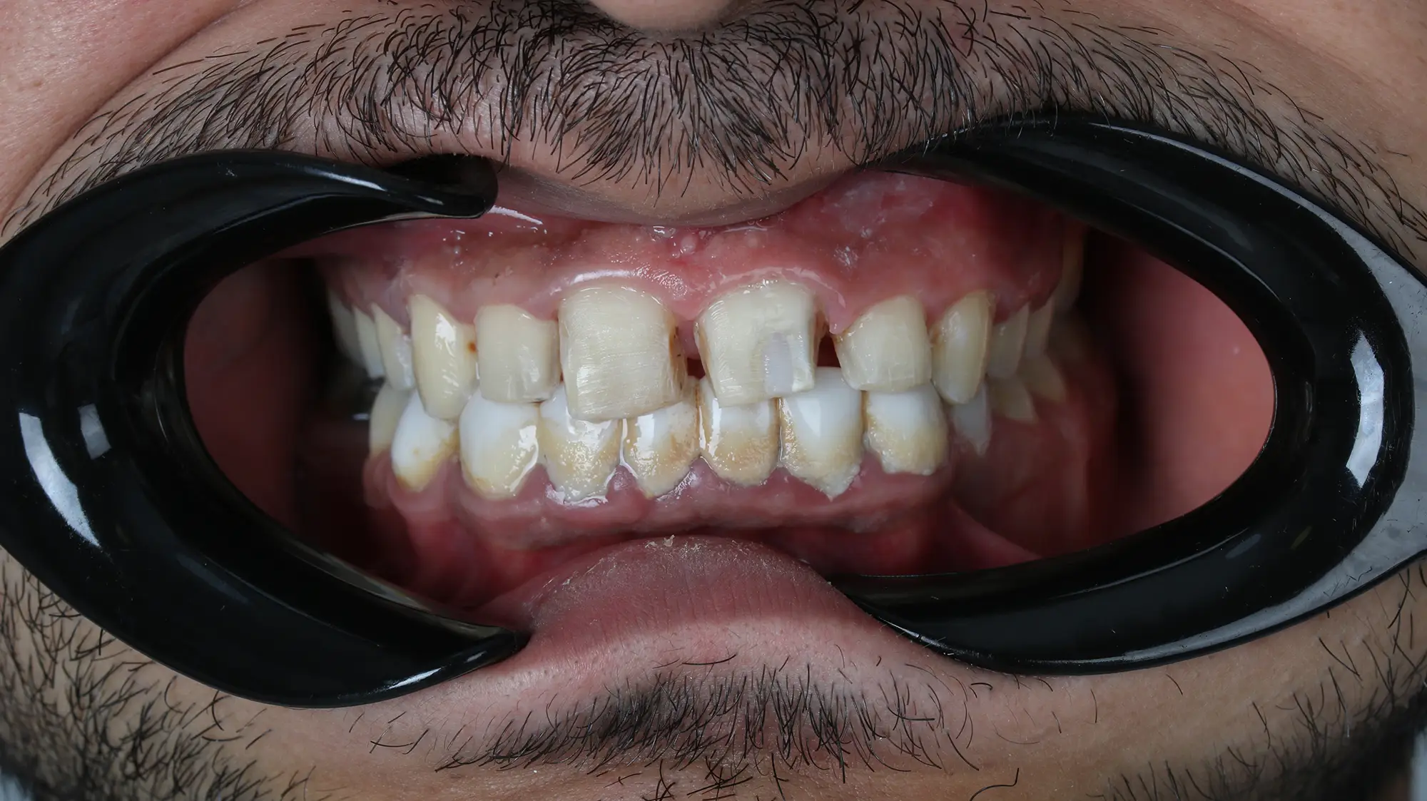 تصویر قبل از درمان