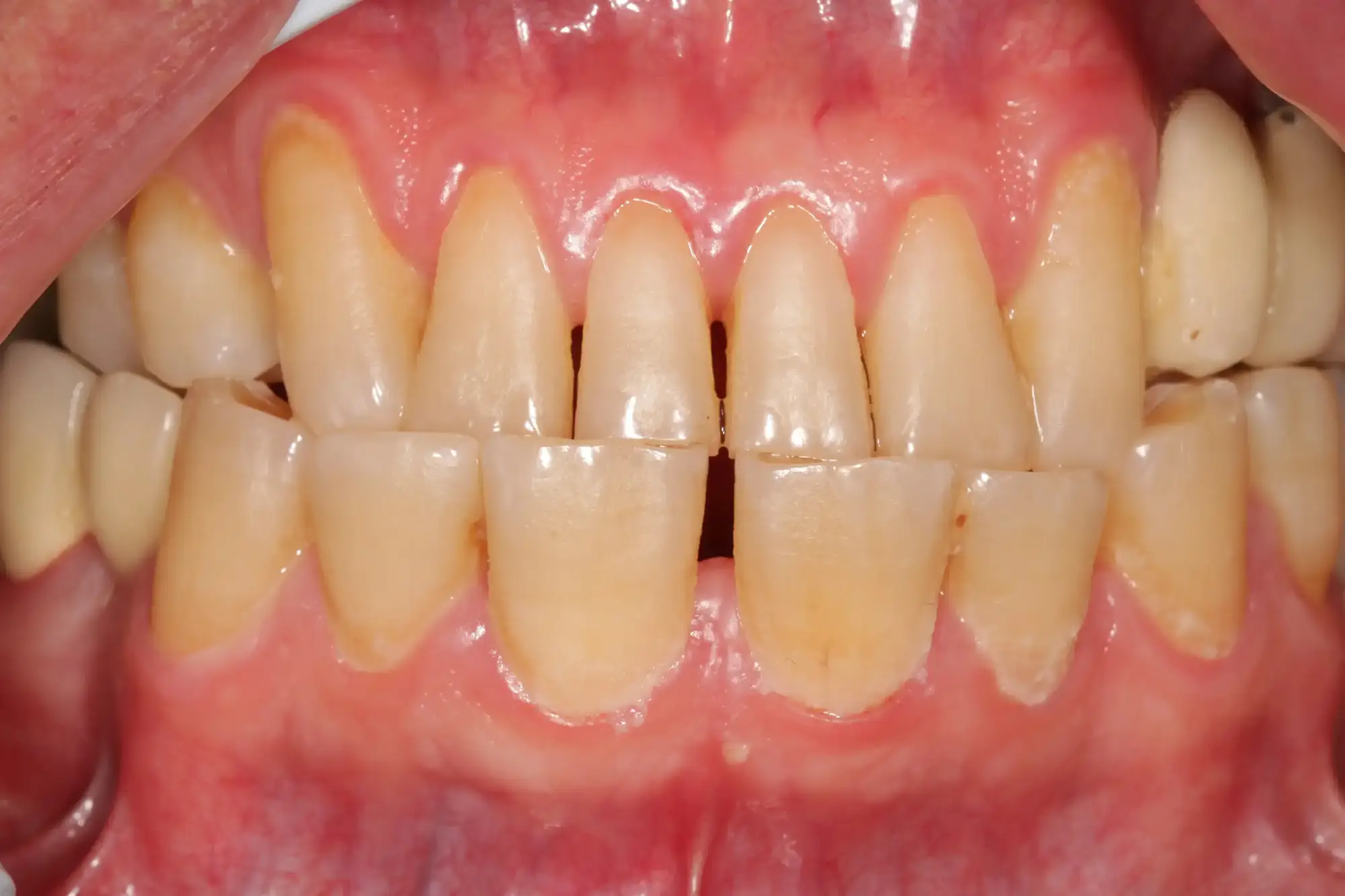 تصویر قبل از درمان