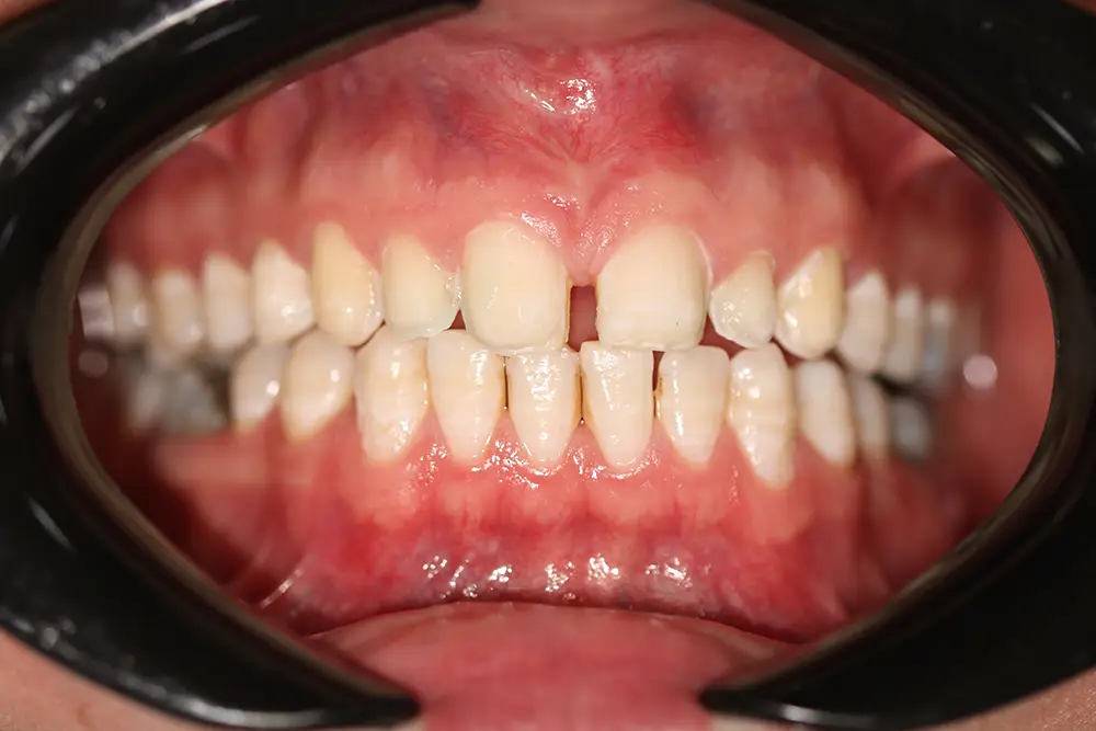 تصویر قبل از درمان