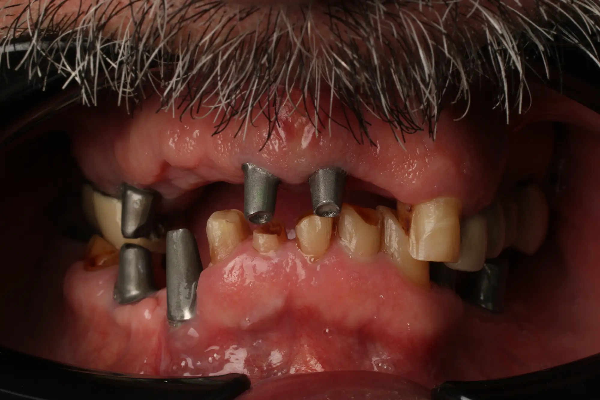 تصویر قبل از درمان