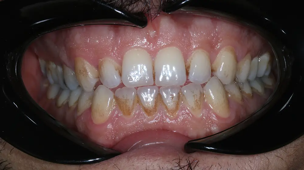 تصویر قبل از درمان