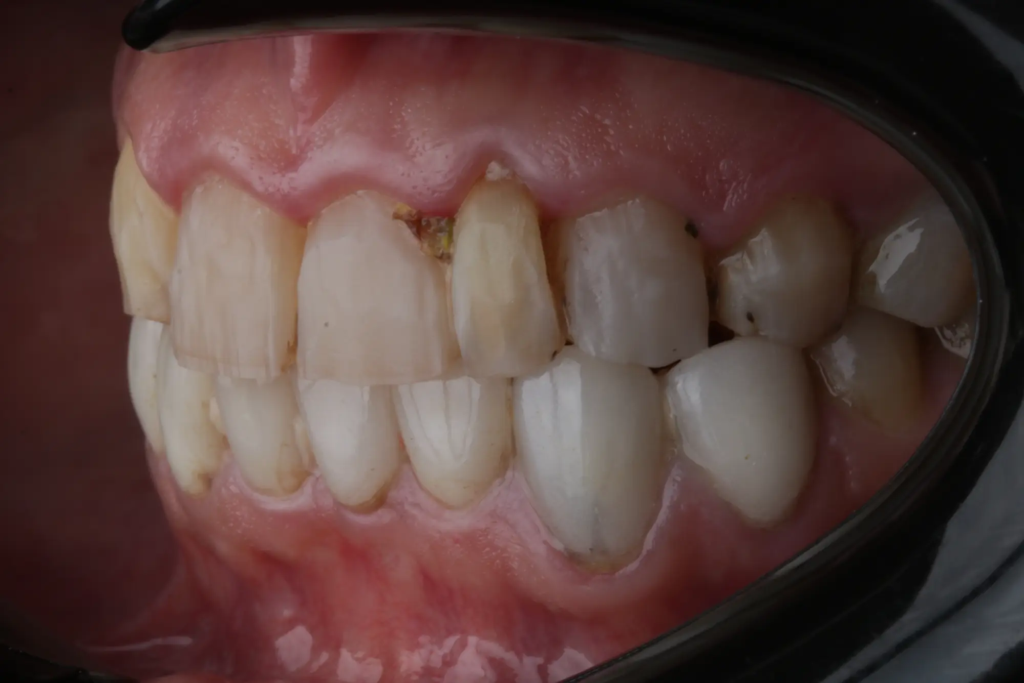 تصویر قبل از درمان