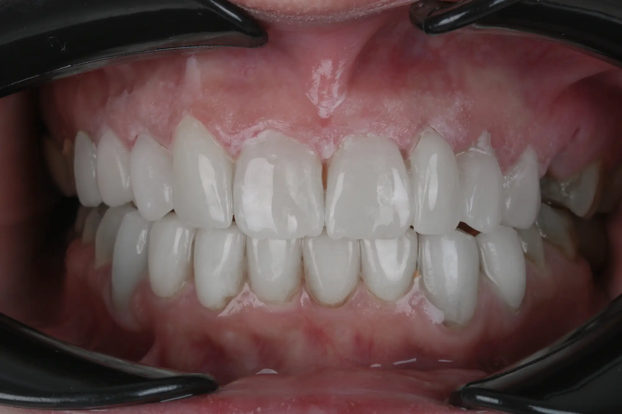 تصویر بعد از درمان