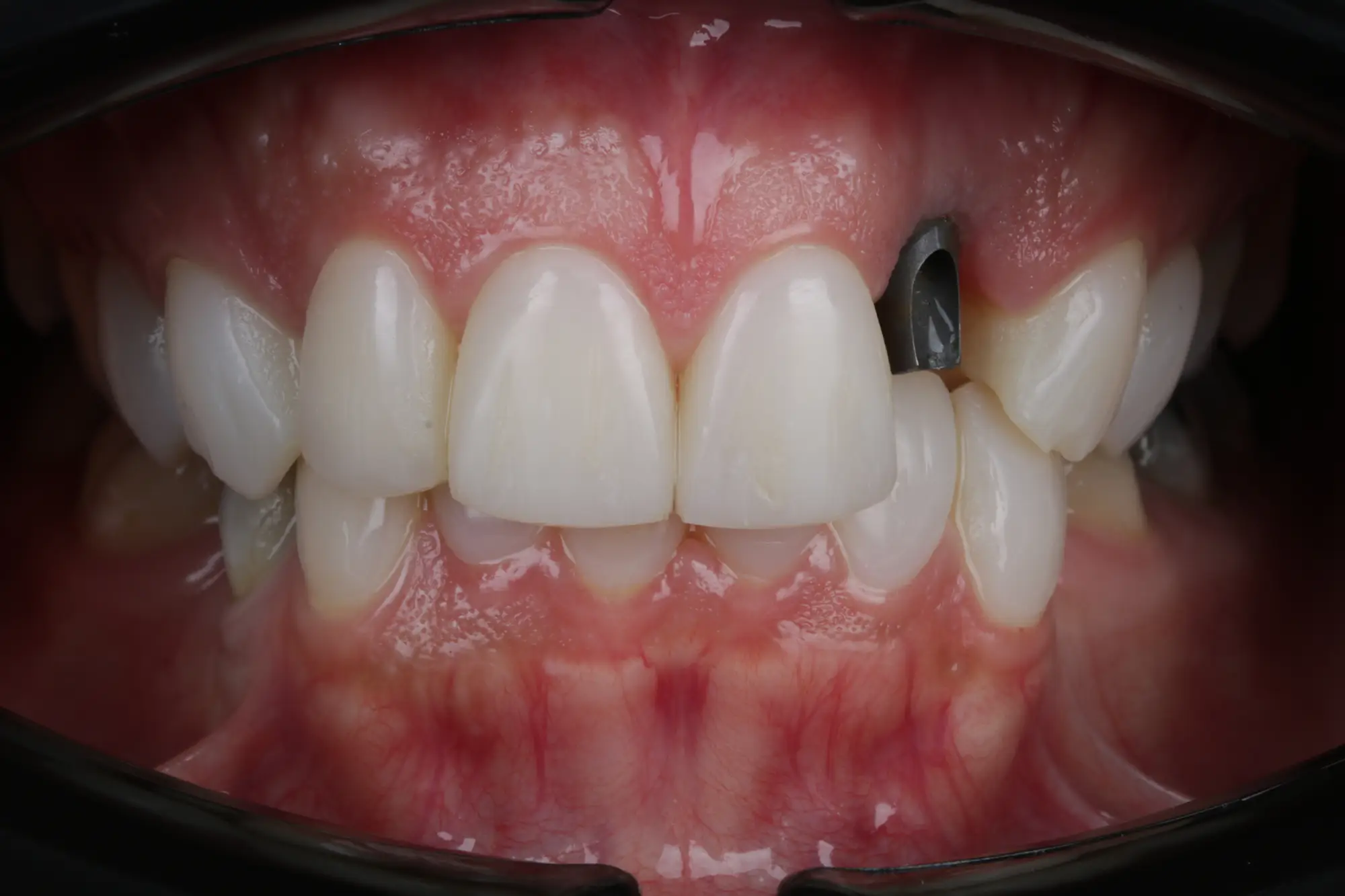 تصویر قبل از درمان