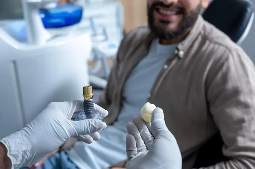 ایمپلنت دندان در جردن تهران راهنمای کامل ایمپلنت دندان