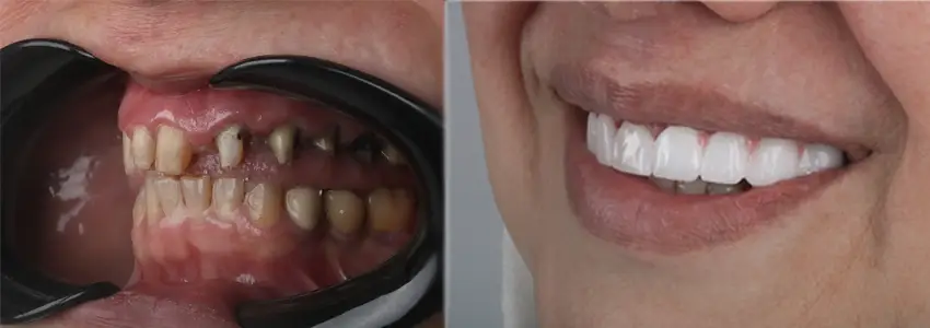 طراحی لبخند در جردن تهران ۱۴۰۴: راهنمای کامل