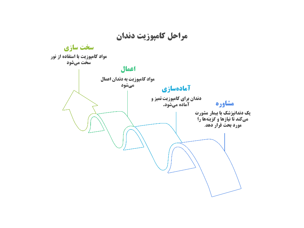 اینفوگرافی لبخند رویایی با کامپوزیت دندان در جردن تهران: راهنمای کامل زیبایی و مقایسه با لمینت