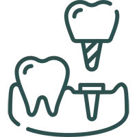 ایمپلنت دندان